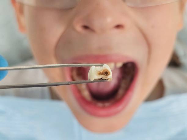 Best Emergency Dentist for Knocked-Out Tooth in National Park, NJ